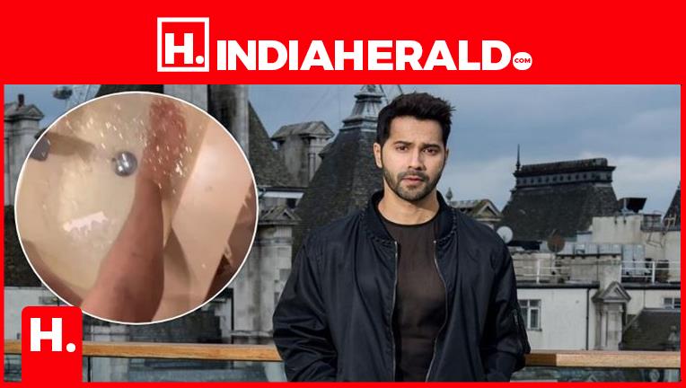 Varun Dhawan Got Badly Injured During The Shooting Of Vd