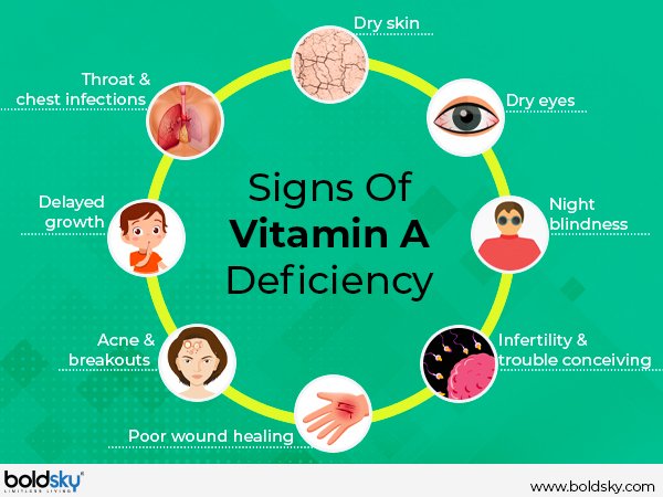 Deficiency Of These Two Vitamins Leads To Loss Of Eyesight