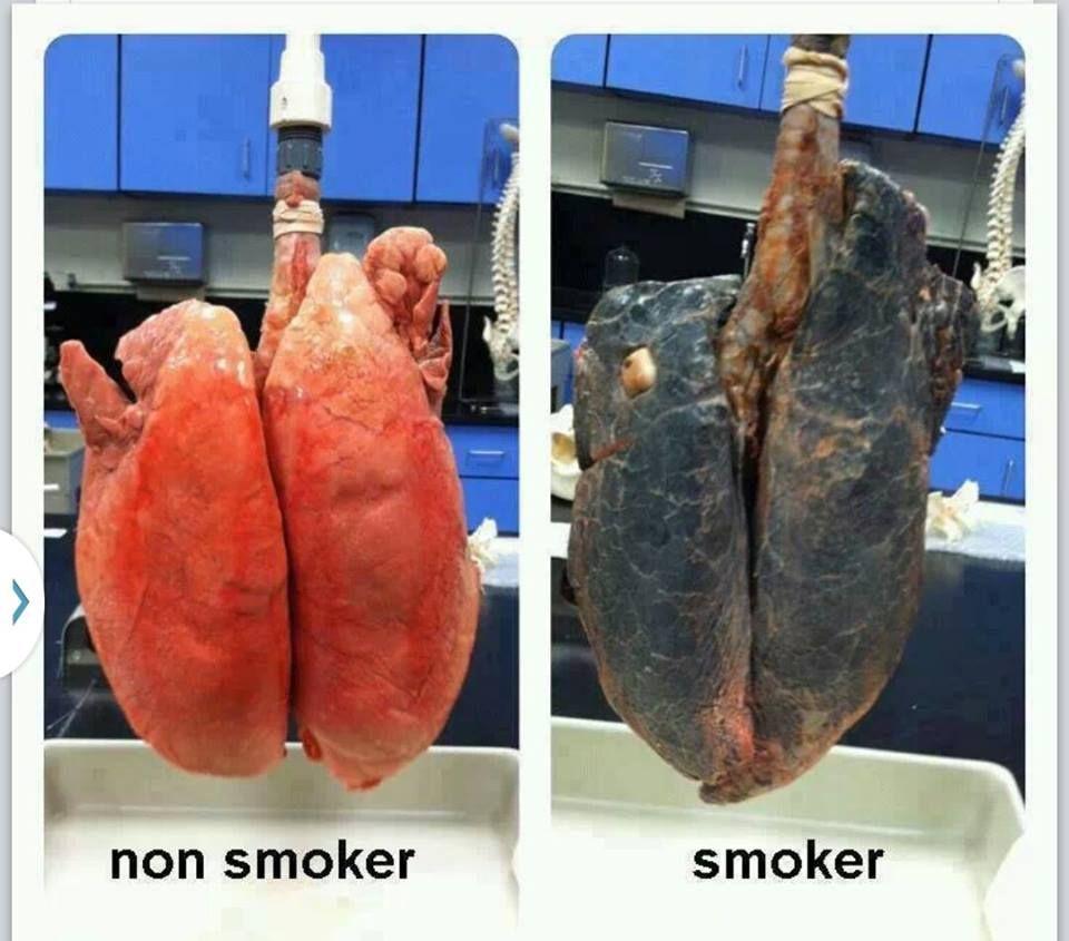 Difference Between Smokers Vs Non Smokers Photos