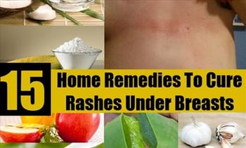 Home Remedies To Get Rid Of A Rash Under Breasts