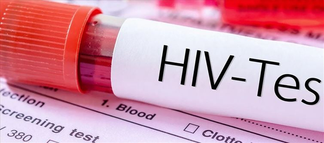 Projected Upward Thrust In HIV-Associated Deaths By Using 2030: