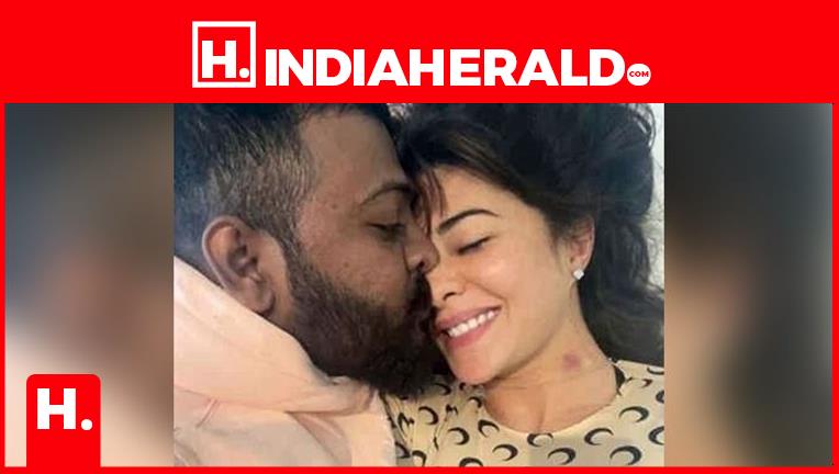 Jacqueline Fernandez Flaunts Her LOVE BITE with Conman - LE