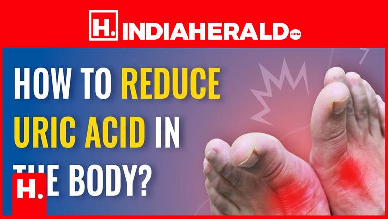 How To Control High Uric Acid 8382